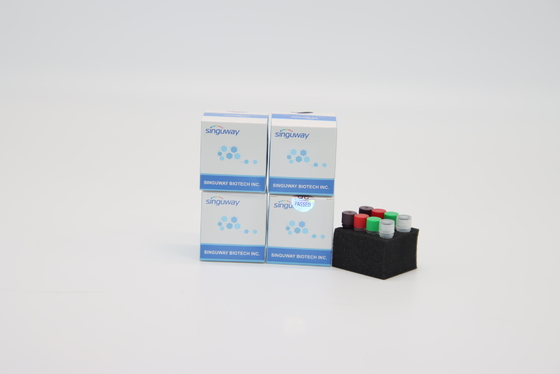即刻HIV PCRテスト キットPOCT IVDの臨床診断実時間PCRの検出のキット