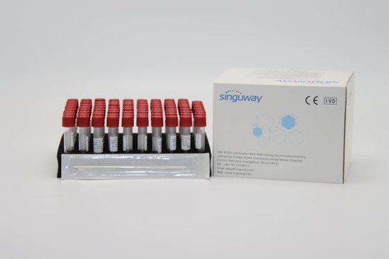 サンプル解放の抽出の試薬のキット ウイルスDNAの抽出のキットISO13485 Singuway