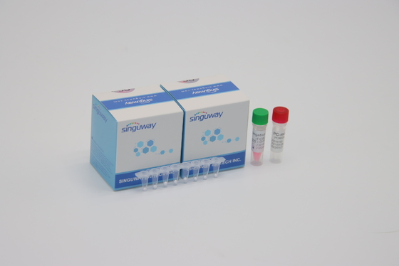 HIVのウイルス量的な蛍光PCRの検出のキットPOCTのリアルタイムのセリウム