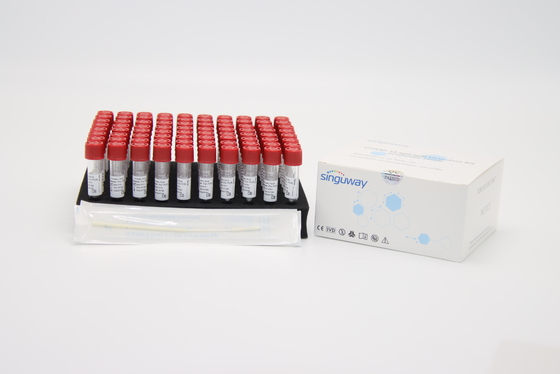 セリウムのウイルスの核酸の分離のキットのウイルスのRNA DNAの抽出のキット1mL/の管