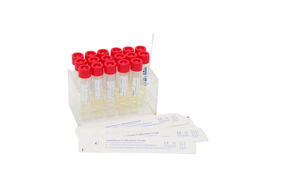 Nasopharyngeal細胞の綿棒の使い捨て可能なウイルスの見本抽出のキットの標本コレクションの管3mL