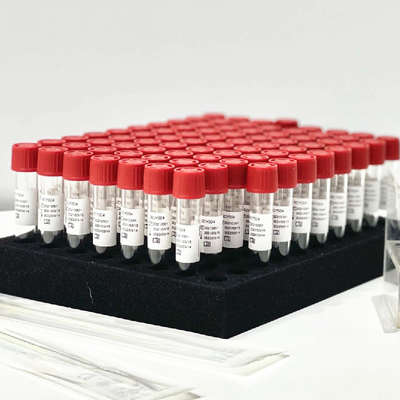 咽頭の前処理のない鼻の綿棒のサンプル解放の試薬の抽出のキット0.5mL/の管